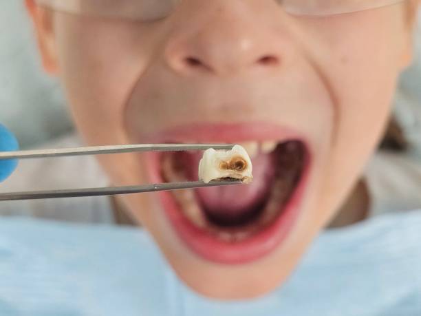 Best Tooth Infection Emergency Dentist  in Rural Retreat, VA